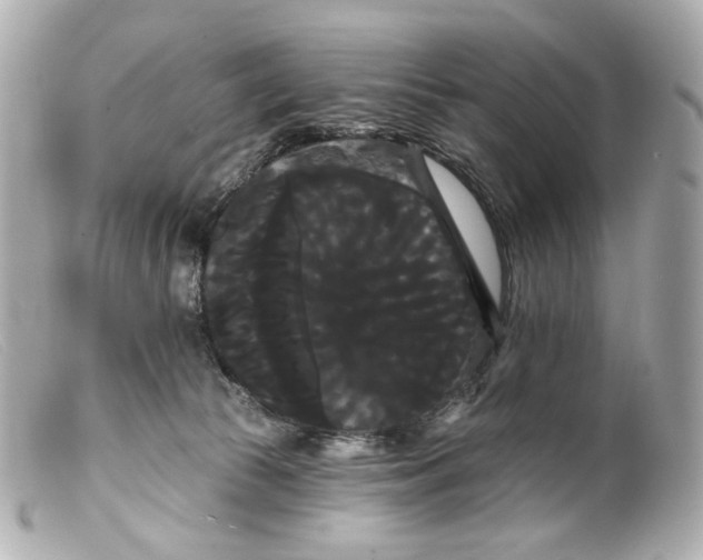 X0000099380177200805291136