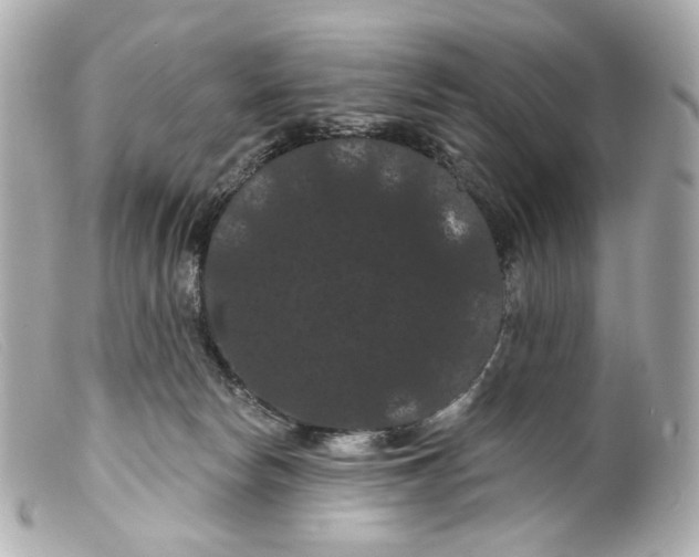 X0000099380178200805291136