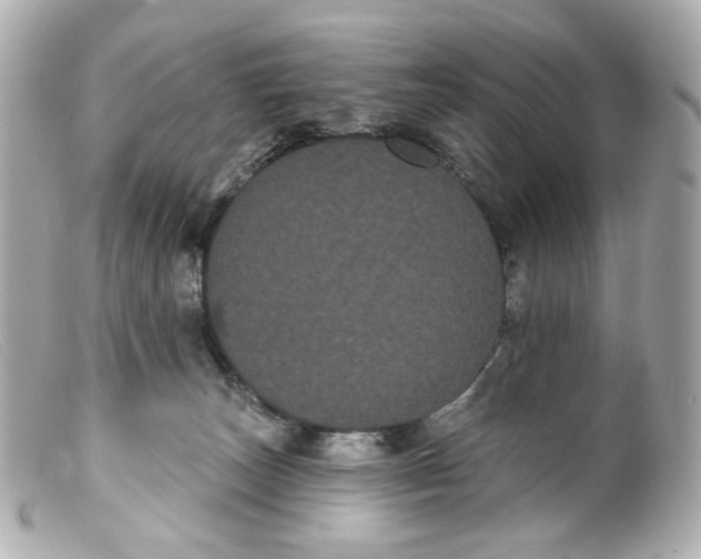 X0000099380179200805291136