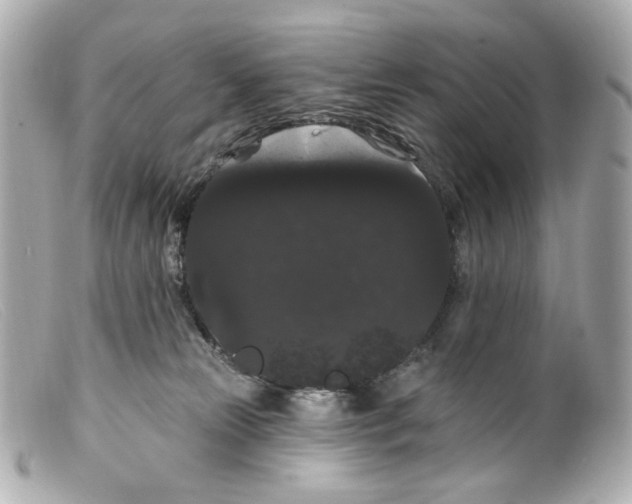 X0000099380181200805291136