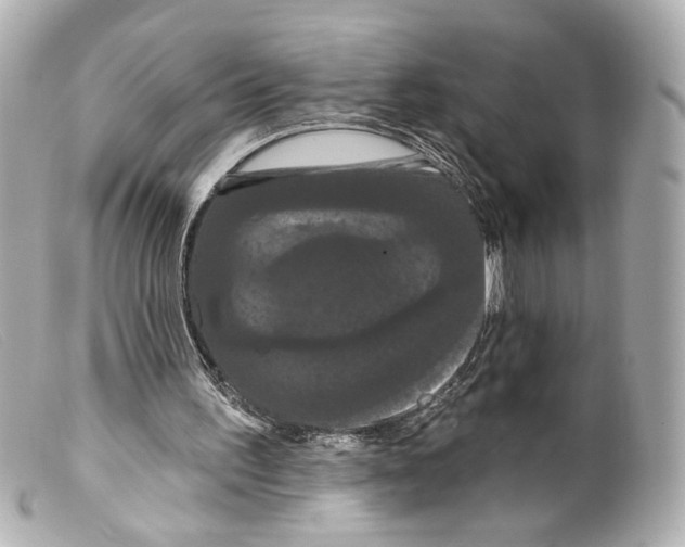 X0000099380195200805291135