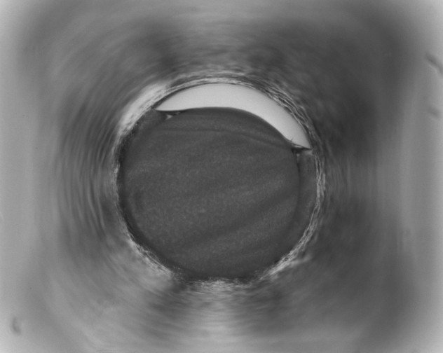 X0000099380197200805291135