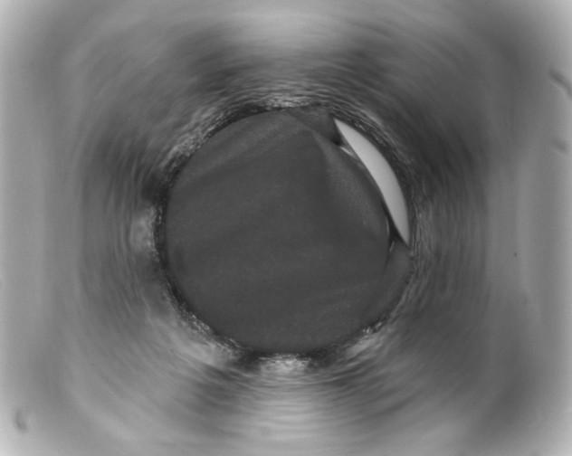 X0000099380217200805291135