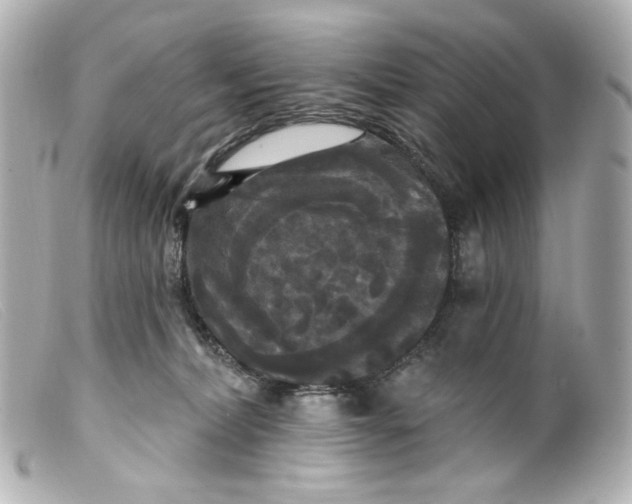 X0000099380228200805291135