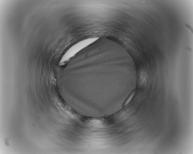 X0000099380236200805291135