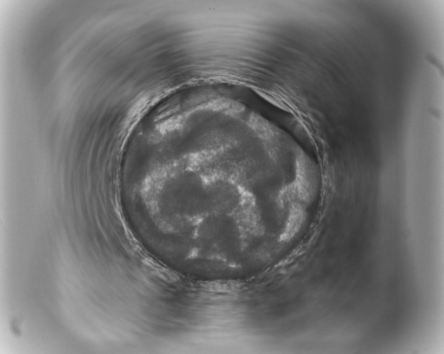 X0000099380241200805291134