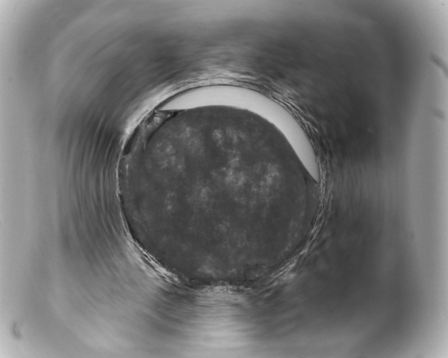 X0000099380244200805291134