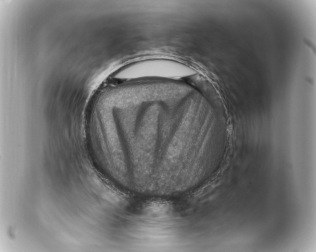 X0000099380248200805291134