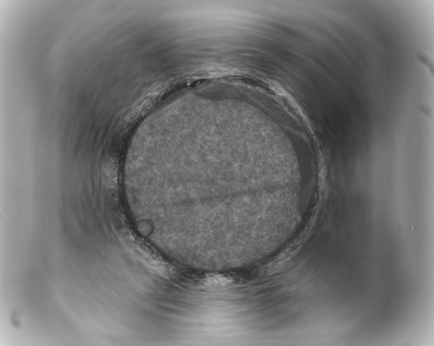 X0000099380257200805291134