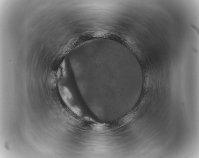 X0000099380273200805291135