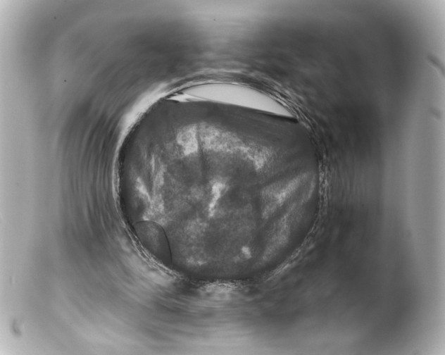 X0000099380294200805291134