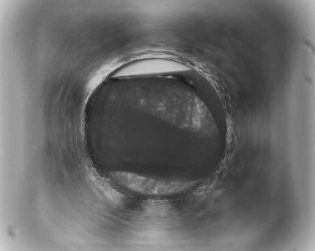 X0000099380296200805291134