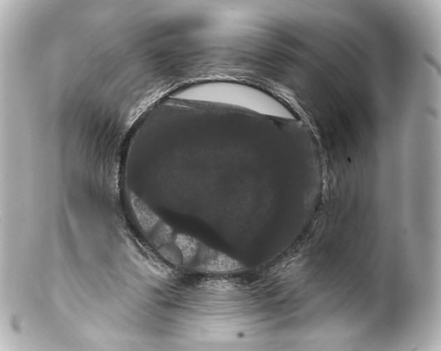 X0000099380299200805291134