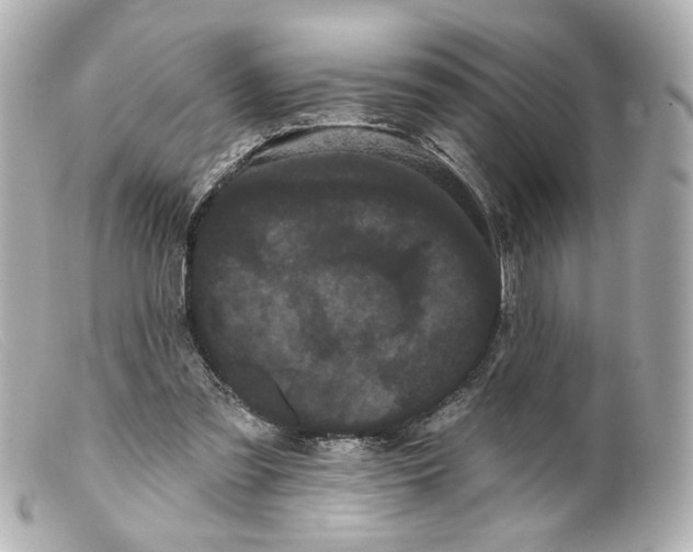 X0000099380301200805291134