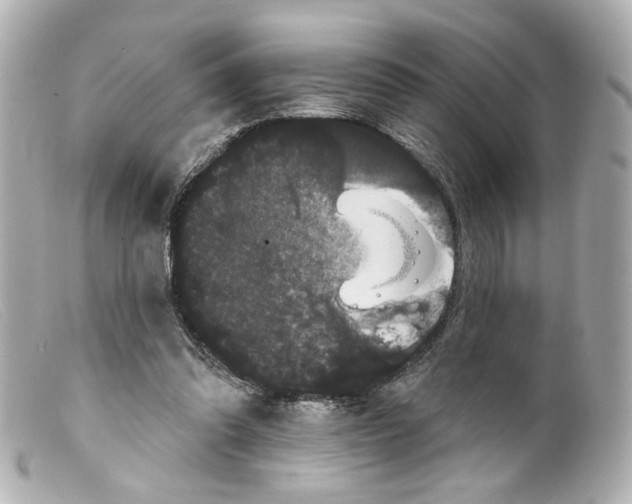 X0000099380302200805291134