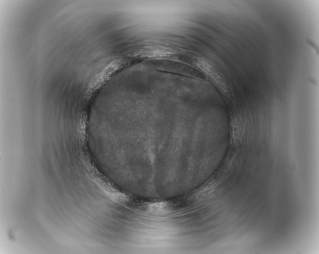 X0000099380309200805291134