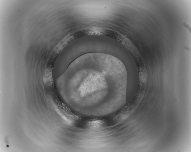 X0000099380312200805291134