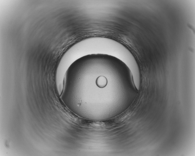 X0000099380317200805291134