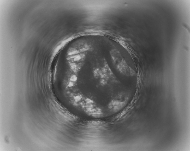 X0000099380342200805291133