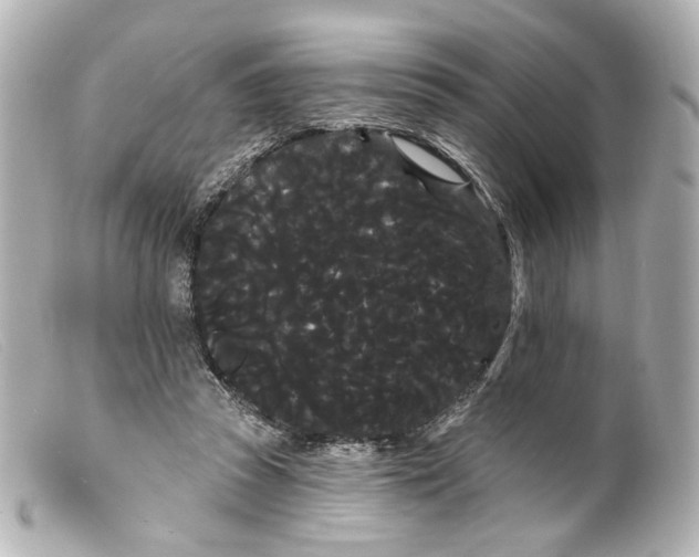 X0000099380353200805291133