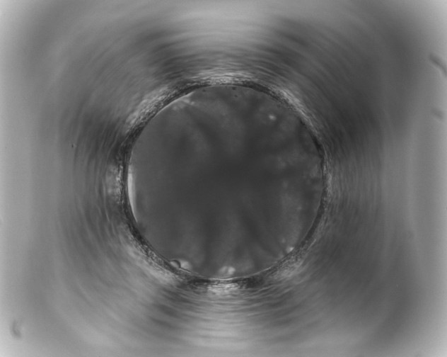 X0000099380357200805291133