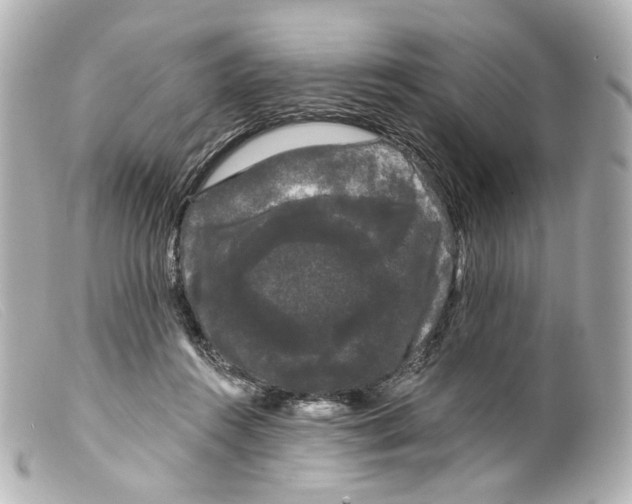 X0000099380360200805291133