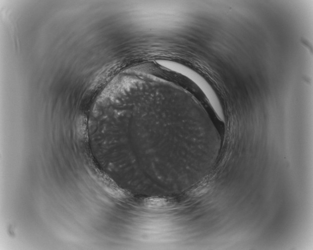 X0000099380361200805291133