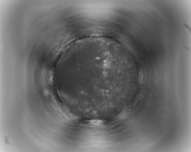 X0000099380363200805291133