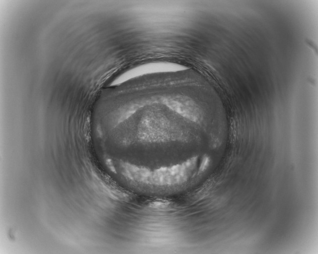 X0000099380364200805291133