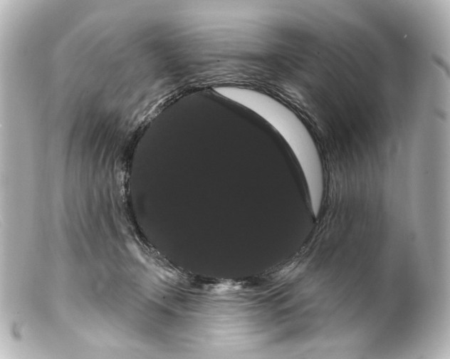 X0000099380366200805291133