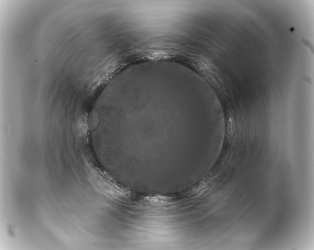 X0000099380367200805291133