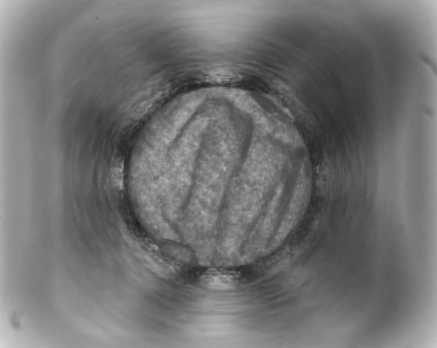 X0000099380368200805291133