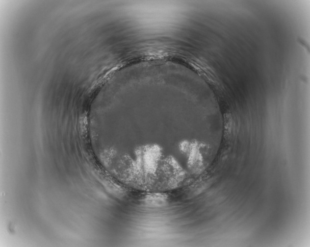 X0000099380369200805291133