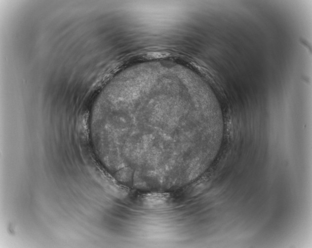 X0000099380373200805291133