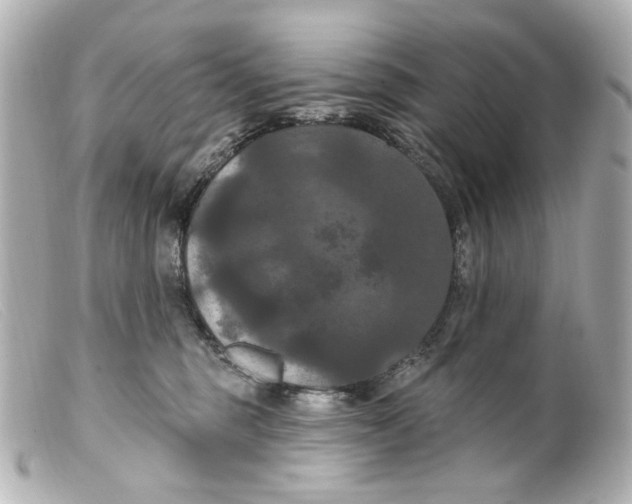 X0000099380375200805291133