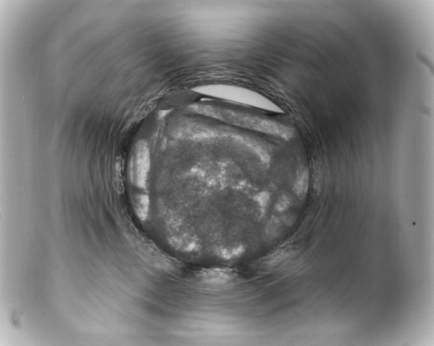 X0000099380378200805291133