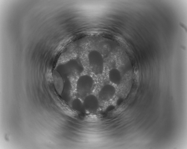 X0000099380381200805291133