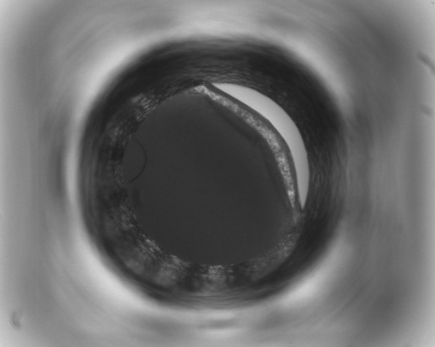 X0000099380383200805291134