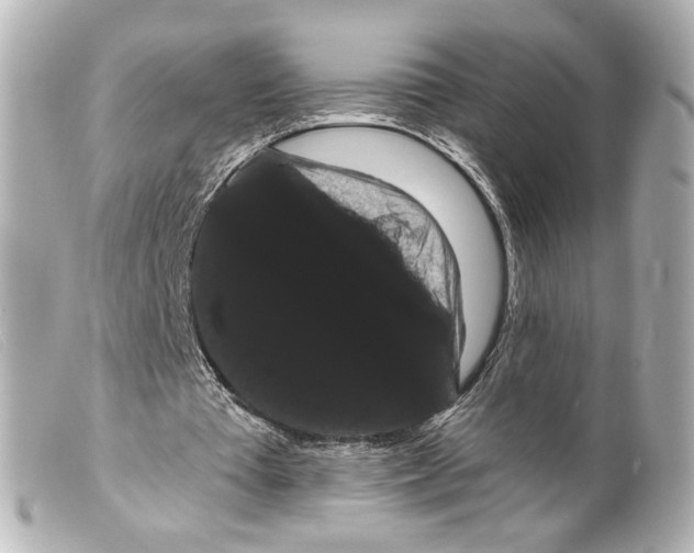 X0000099380385200805291133