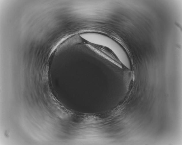 X0000099380387200805291133