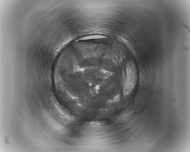 X0000099380394200805291133