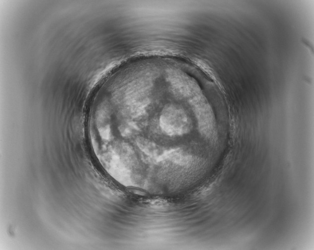 X0000099380395200805291133