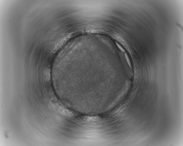 X0000099380401200805291133