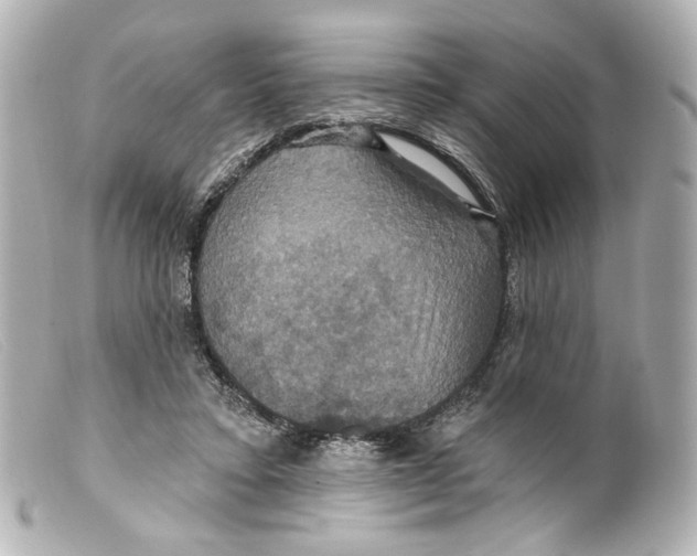 X0000099380403200805291132