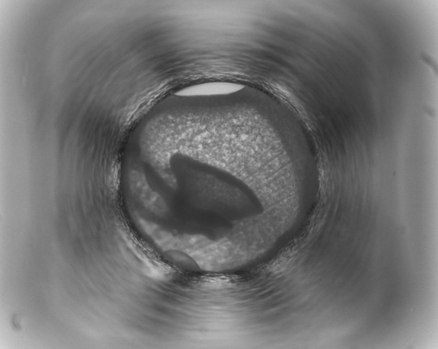 X0000099380405200805291132