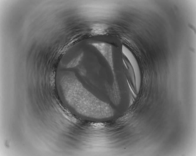 X0000099380409200805291132