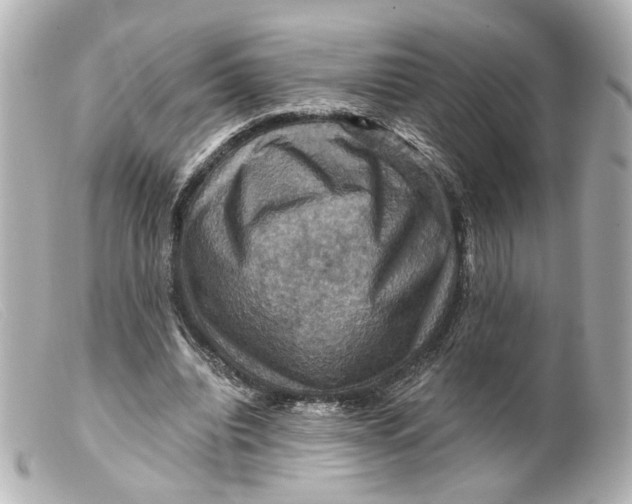 X0000099380440200805291132