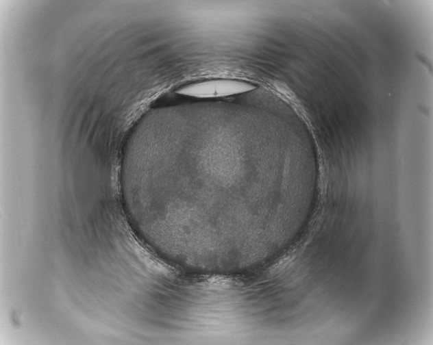 X0000099380441200805291132