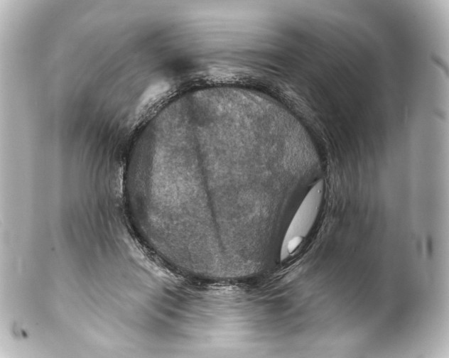 X0000099380454200805291132