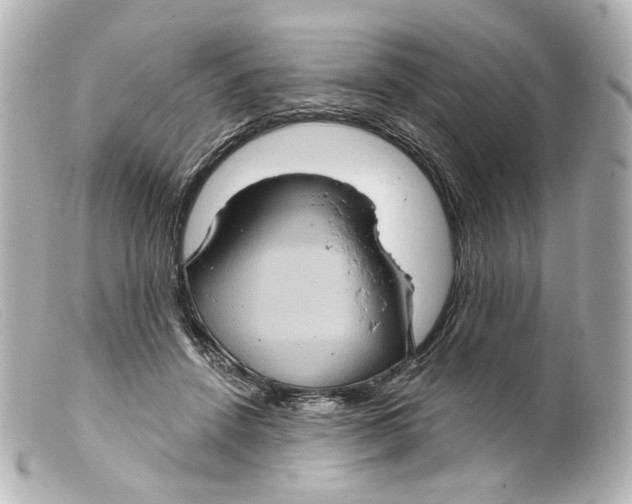 X0000099380456200805291132